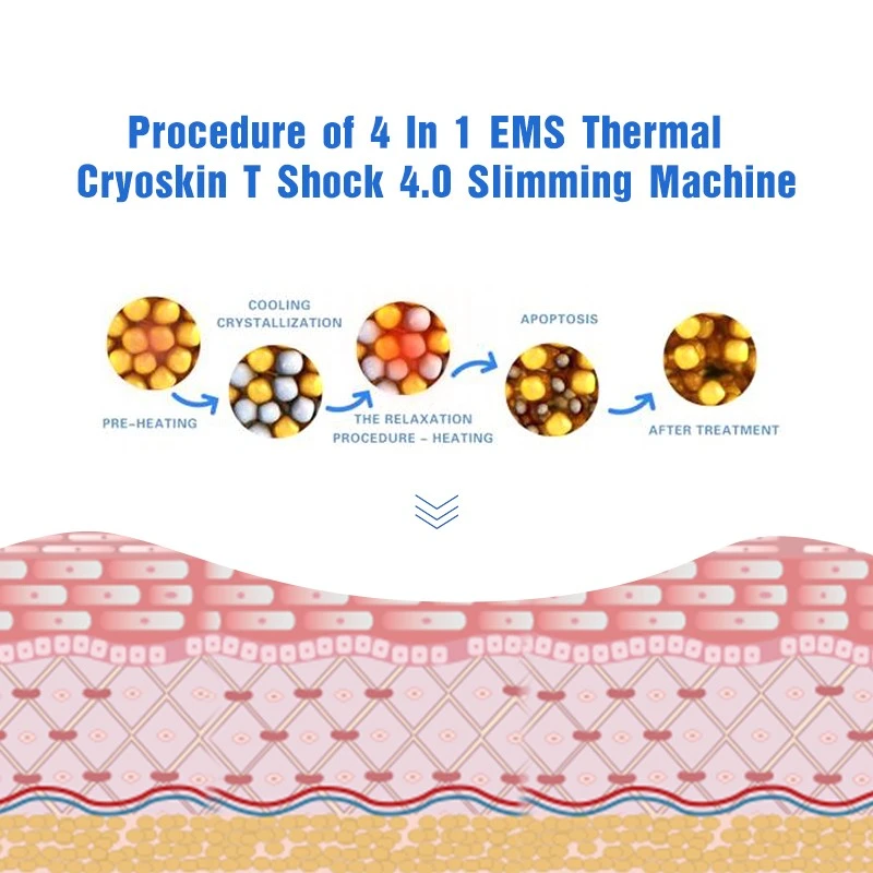 Cryo T Shock Machine Cryoskin 4.0 price